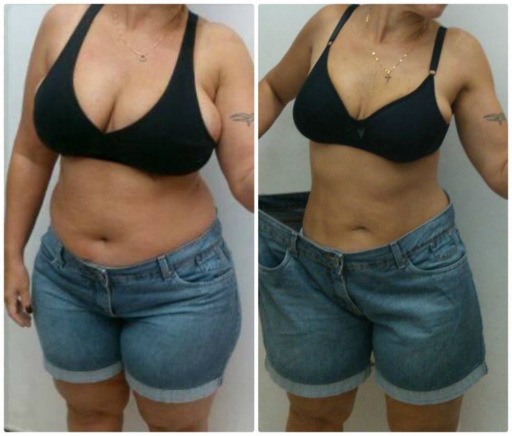 Antes y después - Natalia