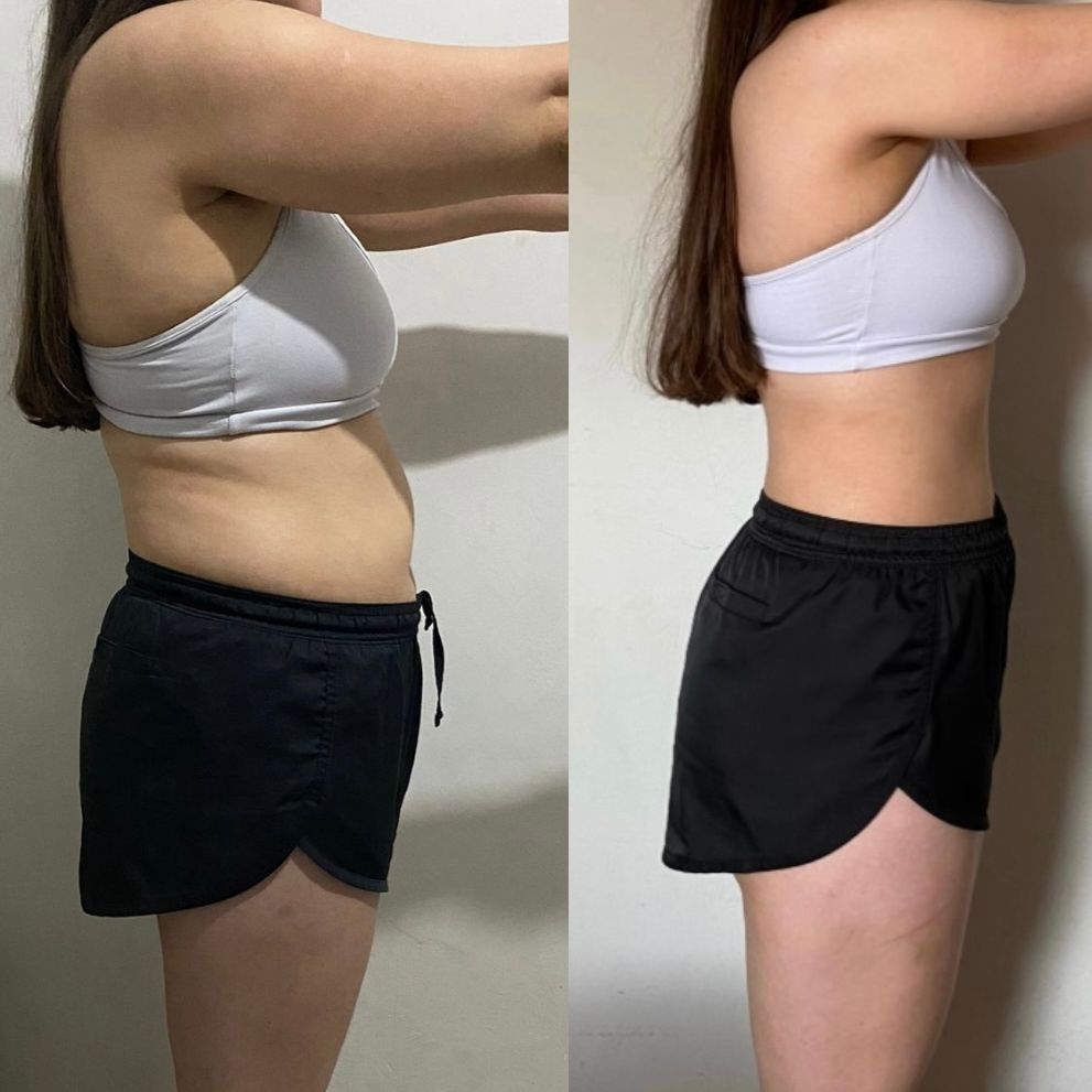 Antes y después - Sofía